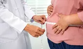 Studiu: două treimi dintre femeile din România consideră obezitatea atât o boală cronică, cât și o problemă de stil de viață