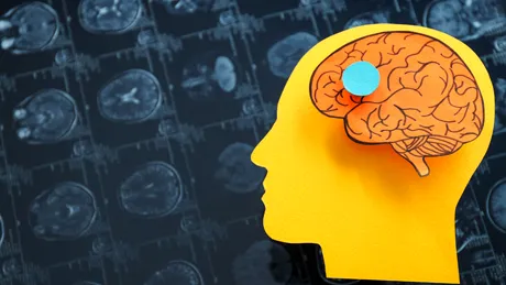 BrainMap, cea mai complexă investigație non-invazivă pentru creier