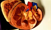 8 cauze care pot duce la blocaj renal. Afecțiunile ascunse care îţi pot afecta grav rinichii