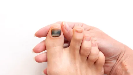 Cele mai ciudate reacții ale corpului la sport, de la gust metalic, la „coregasm”