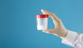 Poate o spermogramă realizată acasă să indice fertilitatea masculină?