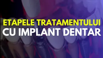 (P) Etapele Tratamentului cu Implant Dentar