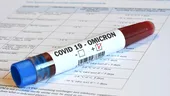 Numărul cazurilor de COVID-19 în România, într-o continuă creștere: 18 decese din cauza virusului în doar o săptămână