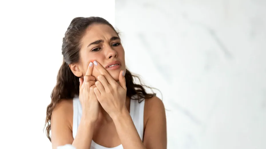 Suplimentul care te ajută atunci când ai probleme cu acneea. Are proprietăți antiinflamatorii și ajută la reglarea producției de sebum