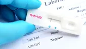 Testare HIV gratuită, la domiciliu, în perioada 23-29 noiembrie