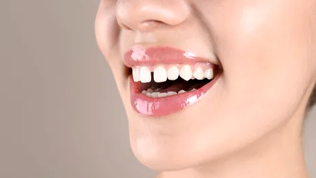 De ce apare strungăreața și cum poate fi corectată