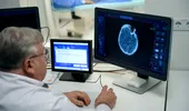 Nu mânca niciodată acest aliment dacă observi acest detaliu! Un neurolog spune că poate ascunde o toxină extrem de periculoasă
