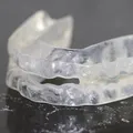 Ce trebuie să știi dacă urmează să porți un aparat dentar invizibil pentru adulți