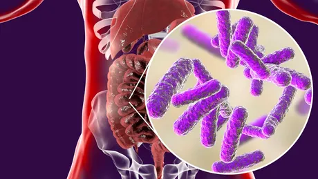 Ce se întâmplă dacă mănânci multe dulciuri când iei antibiotice. Cum are de suferit, de fapt, microbiomul