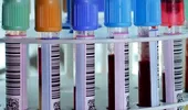 Un simplu test al sângelui ar putea diagnostica în curând 5 tipuri de cancer