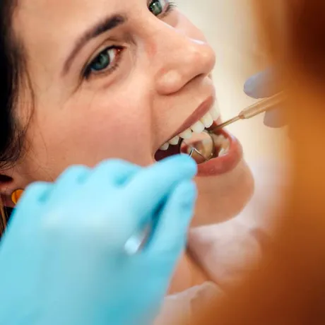 Prevenție sau estetică în stomatologie? Cum s-a schimbat comportamentul pacientului român