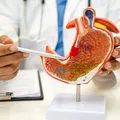 Fructul pe care e bine să-l mănânci pe stomacul gol. Pune ficatul în mișcare și curăță toxinele mai eficient