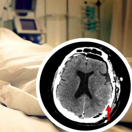 Moartea a fost filmată pentru prima dată în istorie. Care e ultimul nostru gând, chiar înainte de a muri