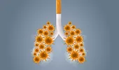 Pneumolog: Fumătorii cu BPOC riscă să dezvolte forme grave de COVID-19