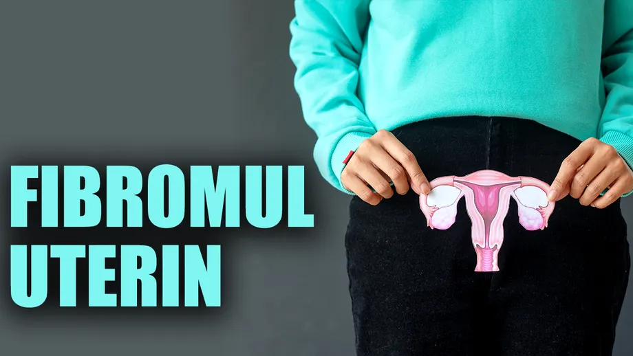 Tot ce trebuie să știi despre fibromul uterin