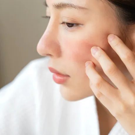 Cele mai nocive alimente pentru piele, dezvăluite de un chirurg plastician! Sunt de evitat dacă vrei un ten ferm