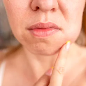 Ce se întâmplă cu dinții și gingiile în timpul menopauzei. Explicațiile medicului stomatolog