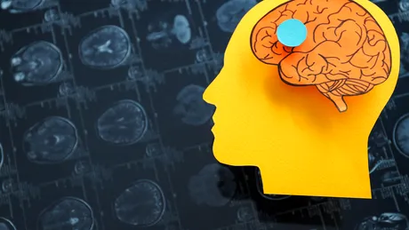 BrainMap, cea mai complexă investigație non-invazivă pentru creier