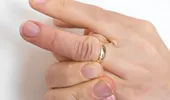 5 motive pentru care ai degetele de la mâini umflate