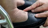 Ai picioare umflate? Boli grave care pot fi semnalate de aces simptom. Nu e de la consumul excesiv de sare și nici de la încălțăminte!