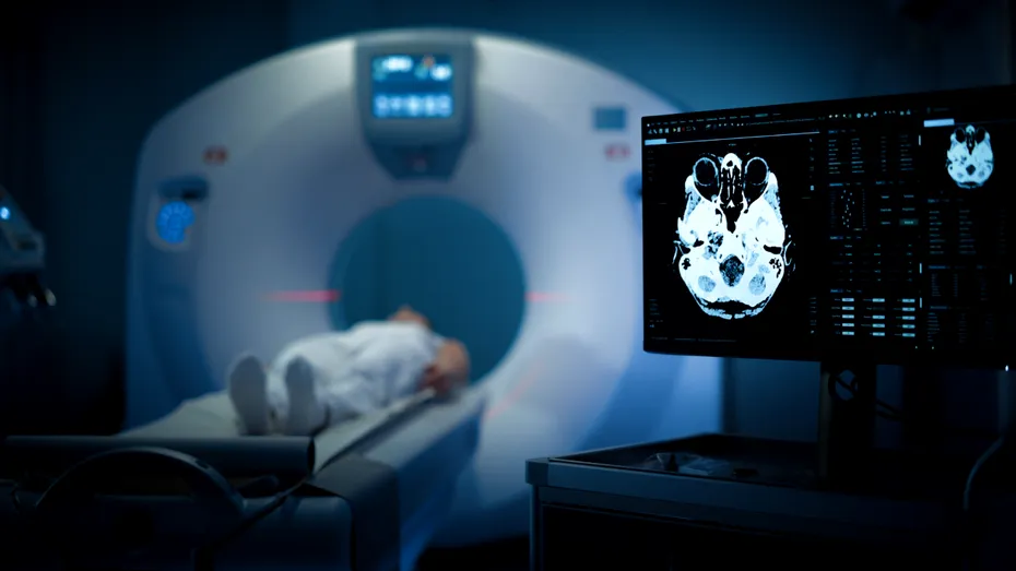 Ce au descoperit medicii când i-au făcut un CT unui bărbat în vârstă de 70 de ani