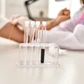 Poate o simplă analiză de sânge să arate cancerul? Ce trebuie să știi despre hemogramă