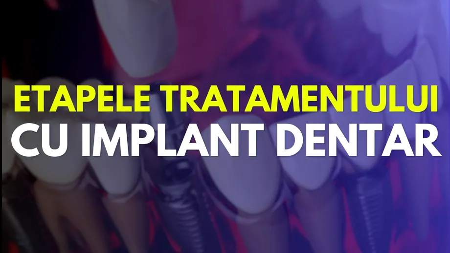 (P) Etapele Tratamentului cu Implant Dentar