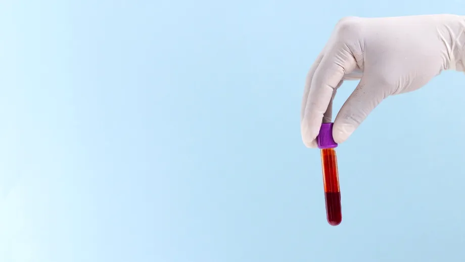 Persoanele cu această grupă de sânge sunt mai puțin predispuse la infarct. Cum le este protejată inima, de fapt