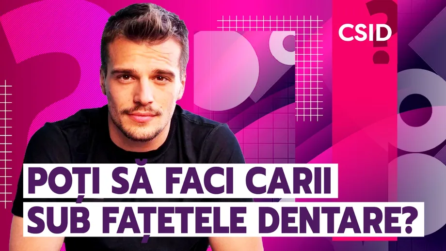 Poți să faci carii sub fațetele dentare?