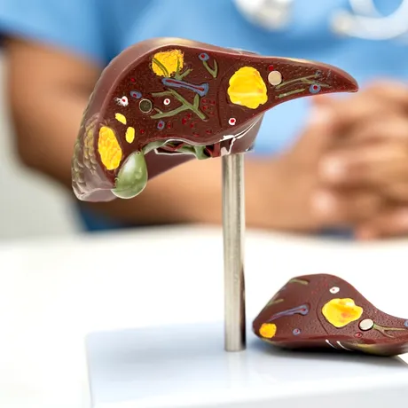 Boala care nu doare, dar afectează tot mai mulți tineri. Pericolul ascuns al stilului de viață modern