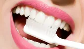 Ce se întâmplă cu dinţii tăi dacă nu îi cureţi corespunzător