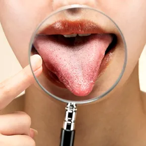 De ce simți gust metalic în gură și când ar trebui să te îngrijorezi