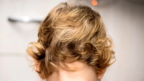 Disgenezia gonadică mixtă: cauze, simptome, tratament