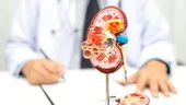 Boala de rinichi poate evolua ani întregi fără simptome. Două analize simple o pot depista din timp