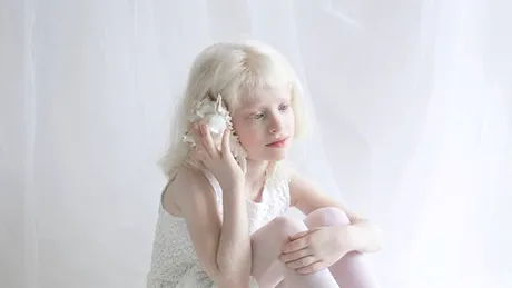 Fifty shades of white - un fotograf surprinde frumuseţea angelică a persoanelor bolnave de albinism