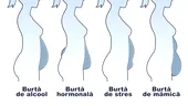 4 tipuri de burtă, în funcție de formă: care sunt cauzele și soluțiile lor