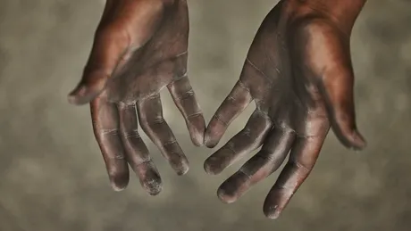 STUDIU: Pompierii au un risc crescut de melanom din cauza expunerii din timpul intervențiilor