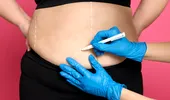 Operația de micșorare a stomacului, salvatoare pentru pacienții obezi: „În jur de 1% dintre persoanele obeze pot slăbi prin metode precum dietă și sport”