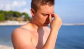 De ce te doare capul după o zi la plajă, chiar dacă ai băut apă. Cauzele pe care poate nu le iei în calcul