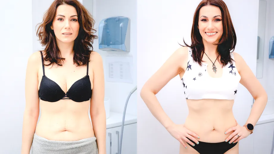 Transformă-ți silueta cu tehnologia ultra-avansată pentru Remodelarea Corporală