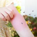 8 plante care te ajută să ții țânțarii departe de balcon în mod natural