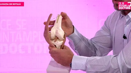 Luxația de rotulă: cauze, simptome și investigații esențiale