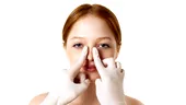 Care este vârsta minimă pentru operația de rinoplastie