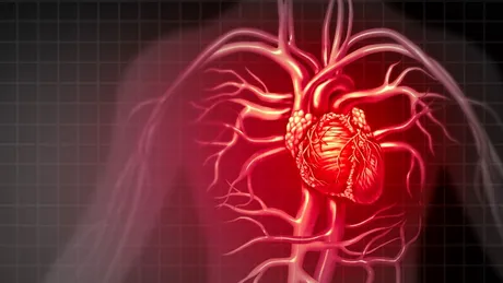 Manifestări cardiovasculare în poliartrita reumatoidă (PR)