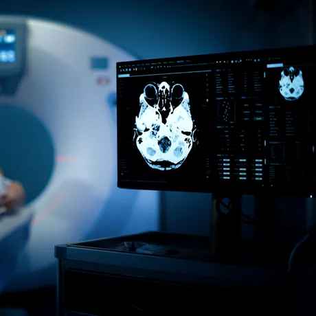 Ce au descoperit medicii când i-au făcut un CT unui bărbat în vârstă de 70 de ani