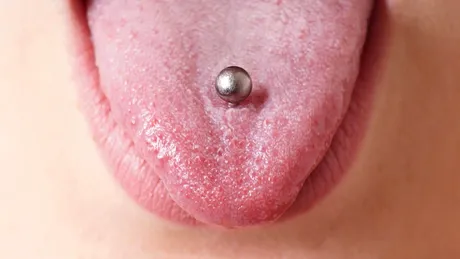 Piercingul în limbă, un pericol pentru sănătatea orală. Cum ne îmbolnăveşte