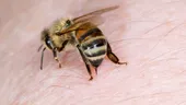Înțepătura de albină - 10 sfaturi care îți pot salva viața