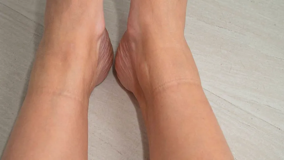 Dacă ai această linie pe picior suferi de boli cardiovasculare. Semne care trec neobservate, dar indică probleme serioase de sănătate