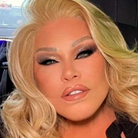 Operațiile estetice fără limite ale Jocelyn Wildenstein: Cum a devenit „Catwoman” la 84 de ani