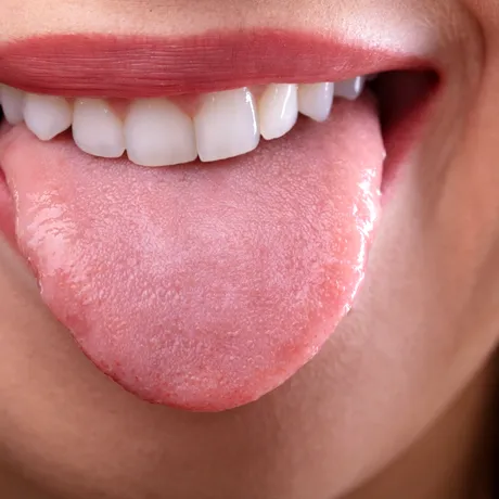 Ce spune culoarea limbii despre starea ta de sănătate